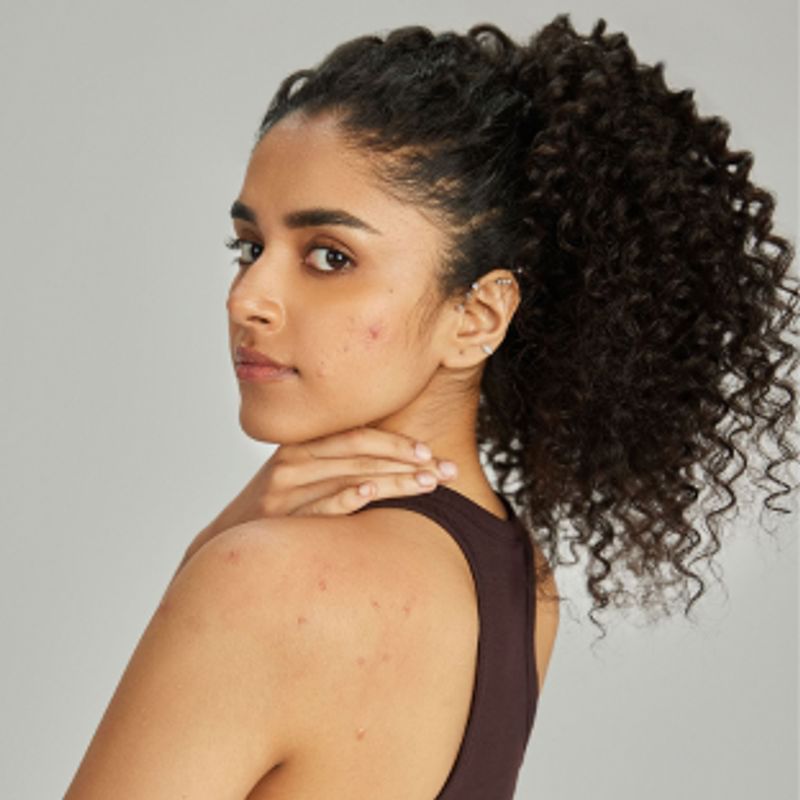 Acne Prevention and Oil Control