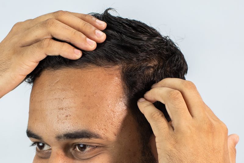 stage 2