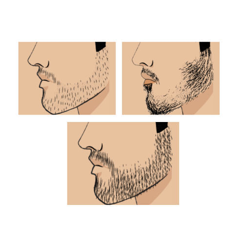 process step 1