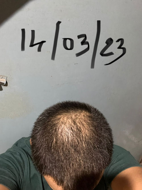scalp of the person who gave the review