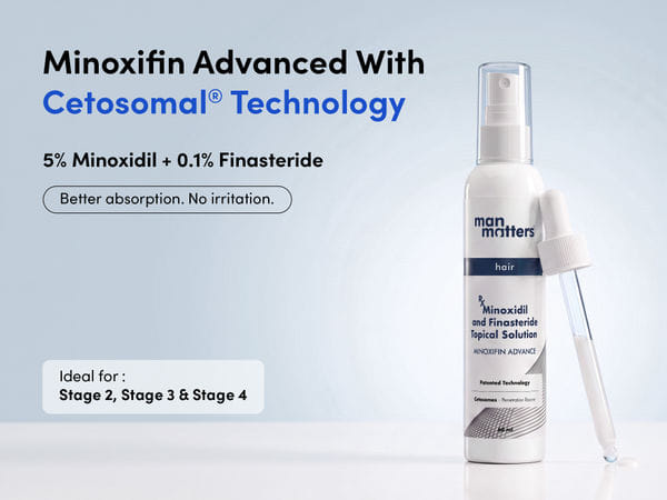 Manmatters 5% Minoxidil + 0.1% Finasteride with Cetosomal Technology - Image 1