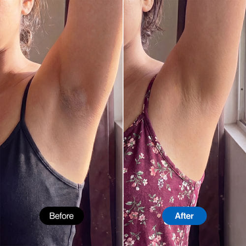 Arunika, 26, Bengaluru