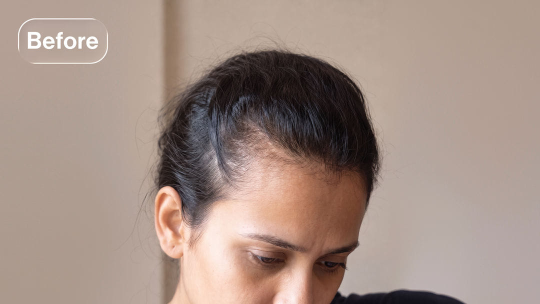 Before treatment
