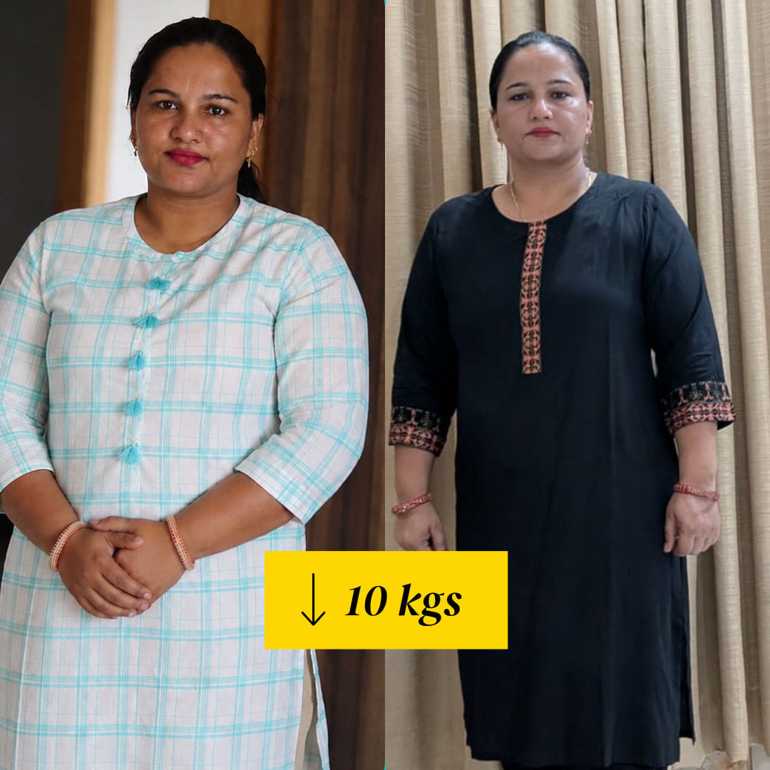 Manju Choudhary before and after
