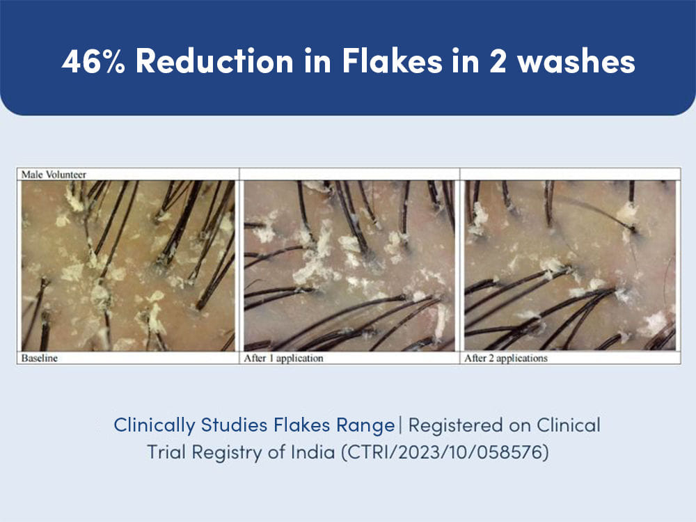 man matters ketoconazole clinical study proofs image