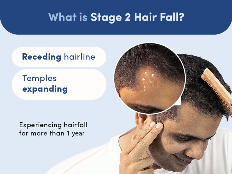 Buy The Hair Starter Pack For Hair Strengthening Man Matters buy-the-hair-starter-pack-for-hair-strengthening-man-matters