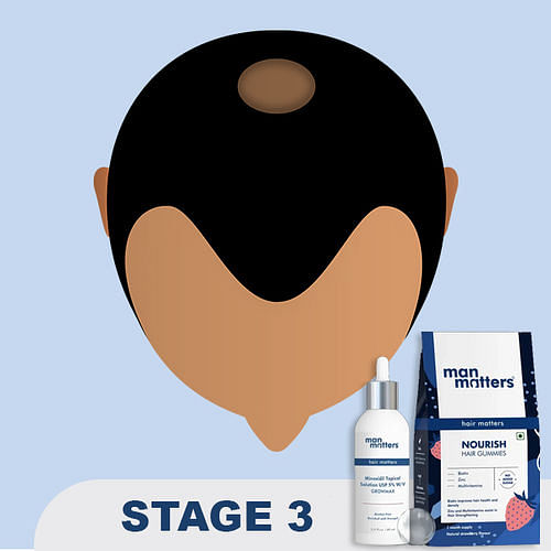 Stage 2 Hair Regrowth Kit