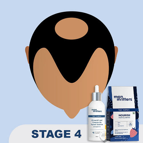 Stage 4 hair loss program