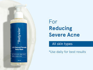 2.5% Benzoyl Peroxide Bodywash