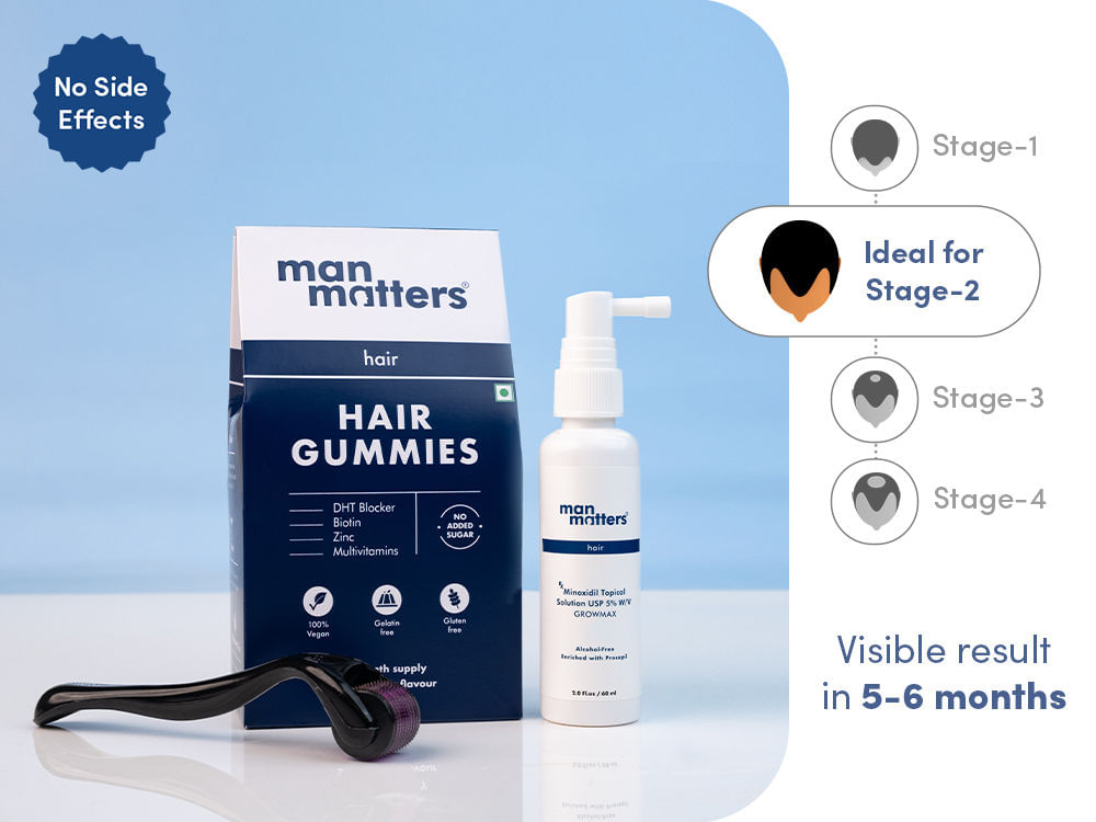 Stage 2 Hair Regrowth Kit (25-34)