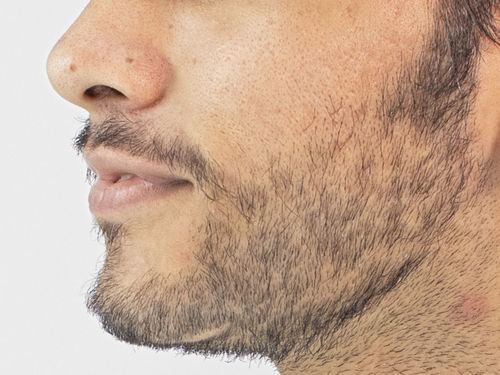 Less Dense Beard Solution