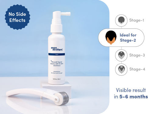 5% Minoxidil Topical Solution (Procapil) + Activator (Derma Roller)