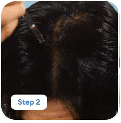 After 3 months - Visible baby hair growth