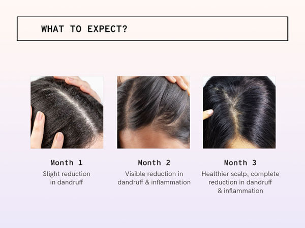 Buy Dandruff Hairfall Kit For Women Bodywise buy-dandruff-hairfall-kit-for-women-bodywise