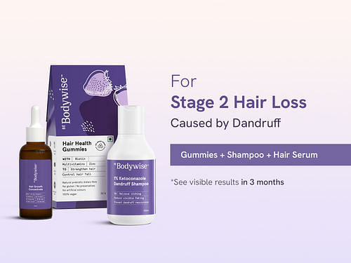 Severe Hair fall & Dandruff
