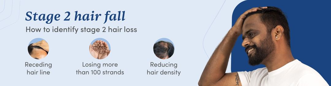 Stage 2 Hair Fall