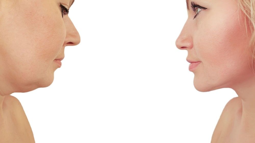 Face Yoga Exercises To Help You Achieve A More Chiselled Jawline