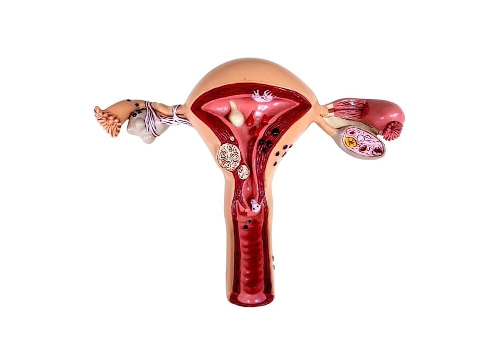 Anteverted Uterus: Causes, Symptoms, Diagnosis, Treatment & More