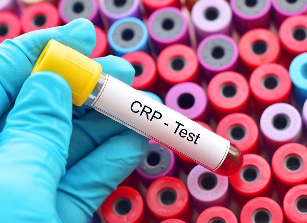 क्या है सीआरपी टेस्ट? | CRP Test in Hindi - Bodywise