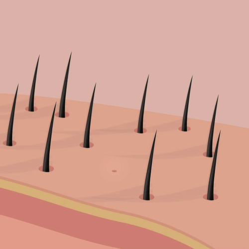 Hair Regrowth