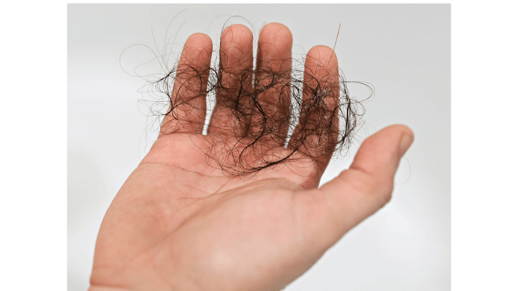 How are stress and hair loss related?
