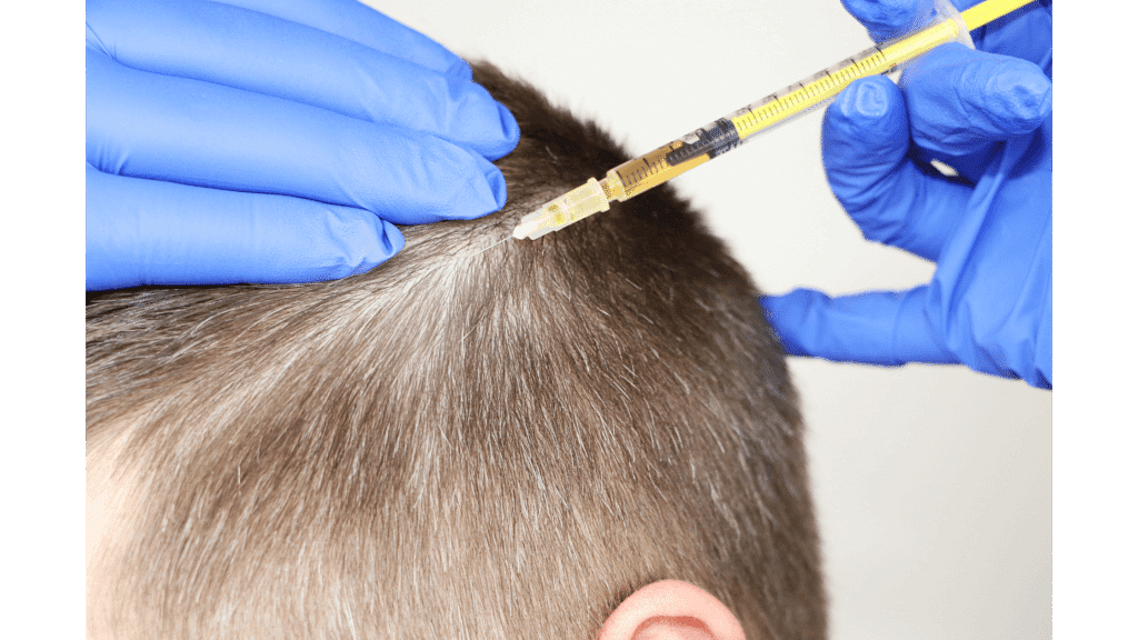Types of hair transplant - FUE vs FUT