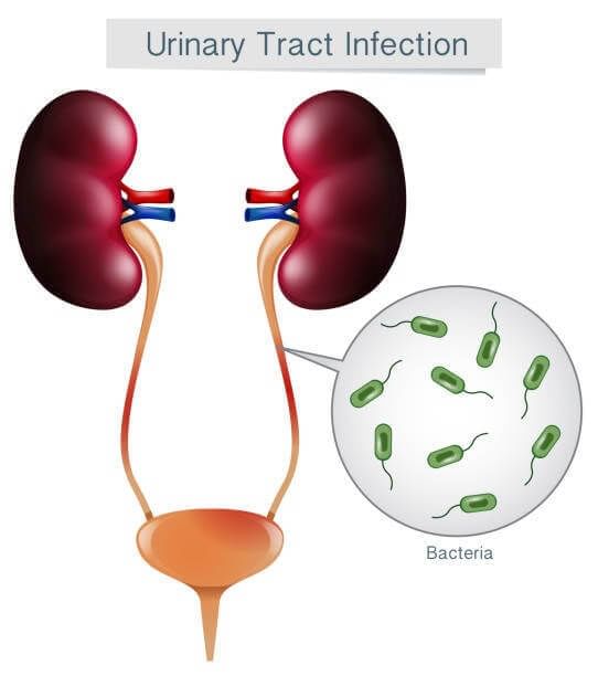 UTI bacteria