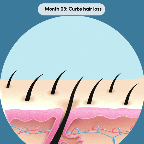 Curbs hair loss