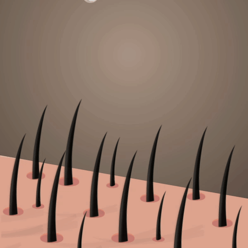 Growth of new beard hair