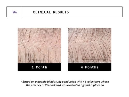 https://i.mscwlns.co/mosaic-wellness/image/upload/v1640335851/staging/products/darkenyl-hair-serum/CAROUSEL/6.png?tr=w-800